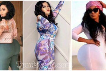 ‘I’m Lucky To Be Alive’ _ Vera Sidika Warns About Cosmetic Surgery After…