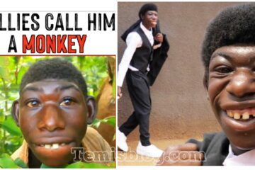 They Called Him Monkey And Now He Is Famous All Over The World…