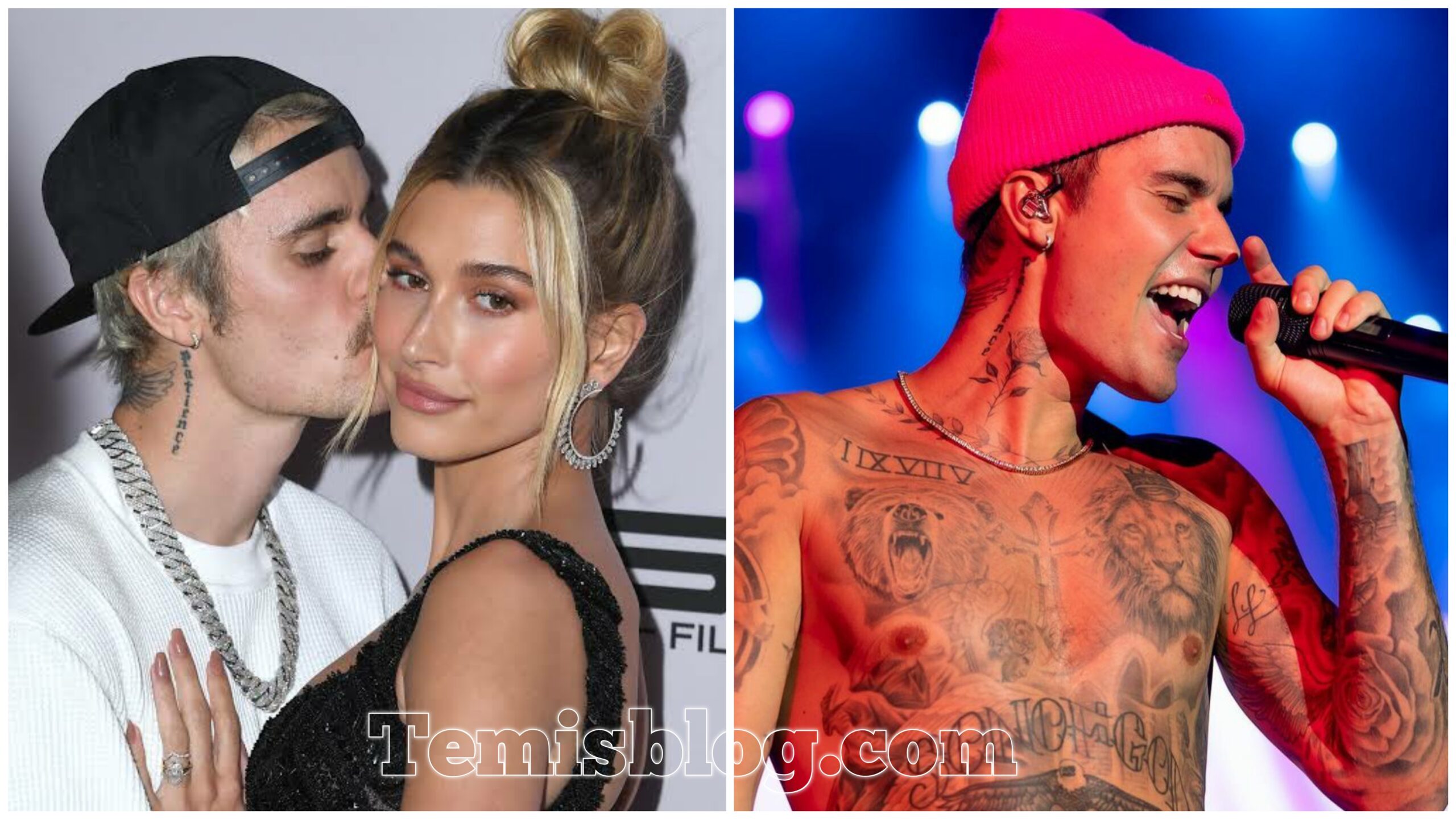 Has Justin Bieber’s Facial Paralysis Affected His Relationship with Hailey?
